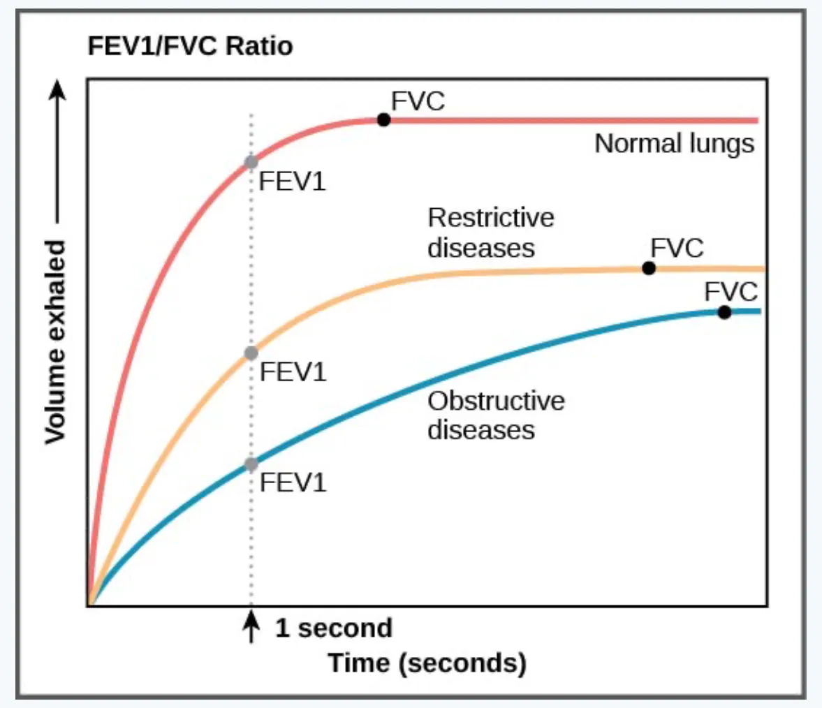 slide:19|type:chart A volume–time spirometry chart comparing normal lungs with restrictive and obstructive diseases. The curves mark FEV1 at 1 second and eventual FVC, i…