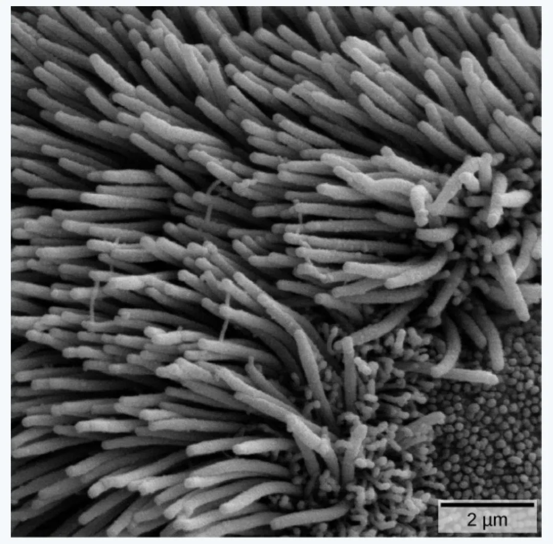 slide:9|type:photo A scanning electron micrograph of dense, hair-like cilia on a bronchial or bronchiolar surface, with a 2 µm scale bar. The cilia project in overlappi…